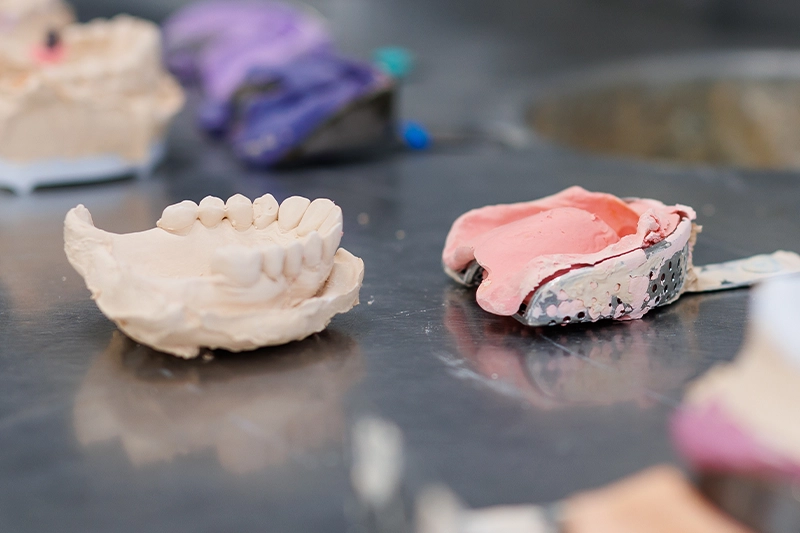 kunstgebit dental esthetics hengelo